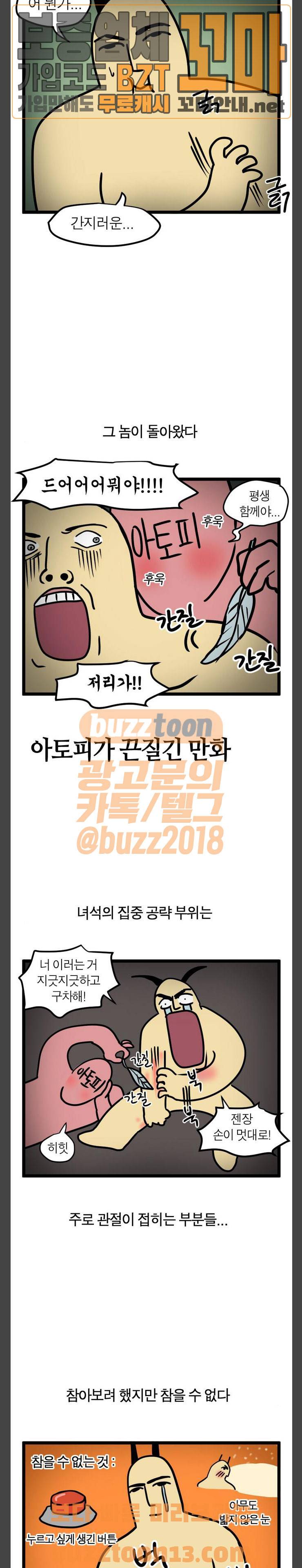 모죠의 일지 27화 - 아토피가 끈질긴 만화 2